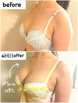 つばききよら/４回で２サイズアップ！