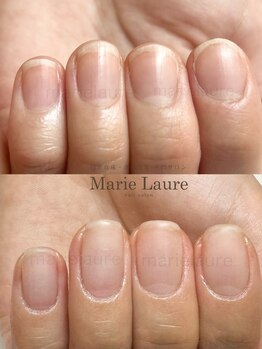 マリーロール 淀屋橋本店(Marie Laure)/自爪育成/深爪矯正/ネイルケア