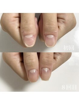 クレア(clea)/ネイルデザイン【浜松/ネイル】