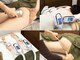 ソフィームの写真/【話題の脂肪冷却痩身がオススメ★】太ももやヒップまわりの気になる頑固な脂肪に徹底的にアプローチ◎
