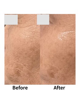 クリニカルスイート エーアール(Clinical sweet.ar)/小ジワ改善