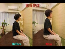 猫背改善！ビフォーアフターで見る驚きの変化