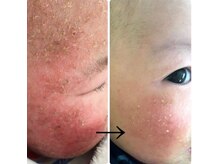 オルオル(Olu'olu)/天恵石鹸(カバノアナタケ石鹸)