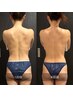 【夏前デトックス！】インディバ越え★WINBACK上半身徹底集中！90分¥24,000→