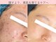 サロンサイ(salonsai)の写真