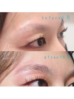 パーフェクトウィンク 新所沢店(PerfectWink)/美眉before /after