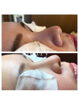 フラフィ 宇都宮本店(fluffy)/回数重ねるたびに綺麗に☆