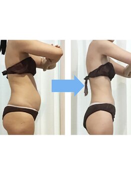 サイズダウンを目指したい