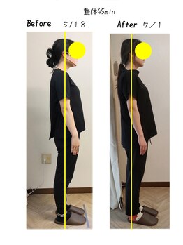 ボディケア メロー(bodycare mellow)/整体45分/ビフォーアフター