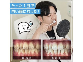 ホワイトニングカフェ 白山店(WhiteningCafe)/☆メンズにも大人気
