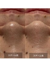 マヴィ(Mavie)/韓国式3D毛穴洗浄