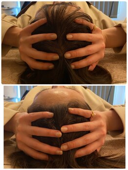 リモド(Rimodo509)/小顔矯正(ヘッドスパ