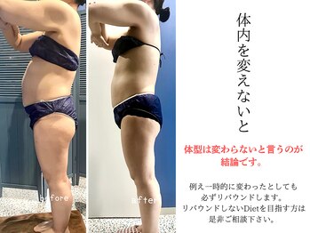 ラヴィアンローズ 各務原店(La vie en Rose)/体内が変わればカラダは変わる