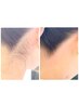 【うなじワックス脱毛】首を長く魅せ美しいアップヘア姿に ¥3300