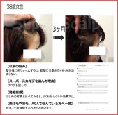 スーパースカルプ 熊本宇城店(SuperScalp)