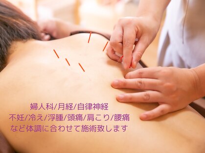里咲紀はりきゅう院の写真