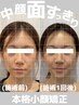 【お試しコルギ60分】小顔矯正コルギ+頭蓋骨はがしで小顔実感！韓国小顔管理