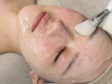 エルピス(ELPIS)/フェイシャル◎