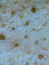 アイムエステ 横浜店(i'm este)/この汚れ…放置しないで