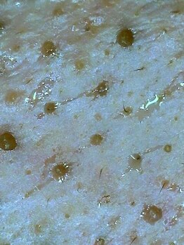 アイムエステ 横浜店(i'm este)/この汚れ…放置しないで