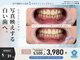 モンキーホワイトニング 西千葉の写真