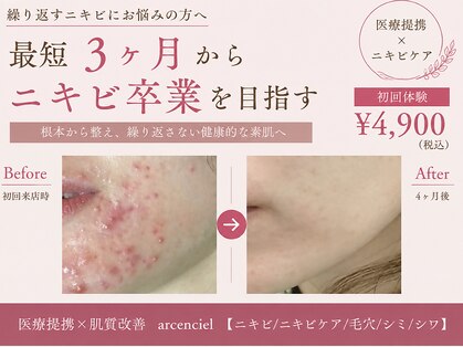 アルカンシエル(arcenciel)の写真
