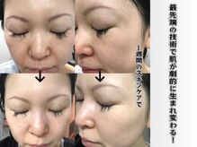 デュライラビューティーサロンルリアン(Dulailah beauty salon le line)の雰囲気（透明感のある生まれたての素肌を目指します♪）