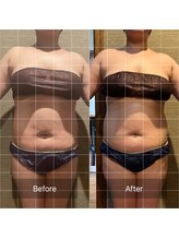 ドットカノア(.Kanoa)/お客様のbefore/after