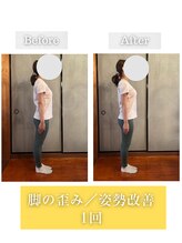 ロータス(LOTUS)/太ももの左右差・腿の張り出し