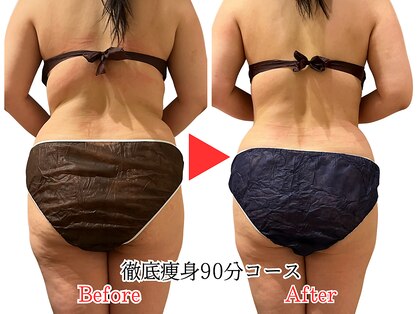 トータルエステティック ビューティスト 足利店(Total Easthetic Beautist)の写真