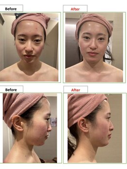 エステティック レイビス 銀座店(RAYVIS)/