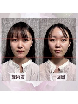 エレーニ 麻布十番(ELENI)/キュッと短くコンパクトな印象に