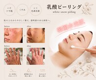 アフロディーテ(Aphrodite)