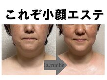小顔専門サロン ラリューシュ(La ruche)