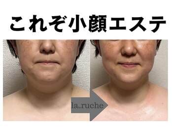 小顔専門サロン ラリューシュ(La ruche)の写真/憧れのキュッと引き締まった立体的な小顔を実現！目元もパッチリ＆鼻筋もシュッ◎埋もれた輪郭もスッキリ♪
