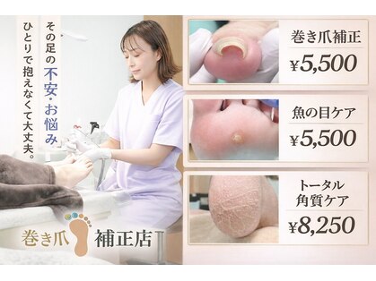 巻き爪補正店 名古屋駅前店【巻き爪・角質・たこ・魚の目】【10月1日OPEN(予定)】の写真