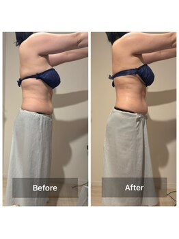 ユーフォリアプラス(euphoria +plus)/モニターキャンペーン