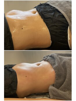 ウル(Ulu)/腸もみビフォーアフター