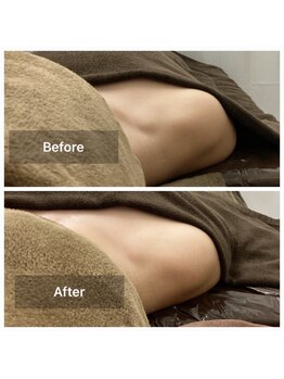 リアン(Lien)/before after