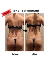 エクラ(ECLAT)/コアヒート痩身