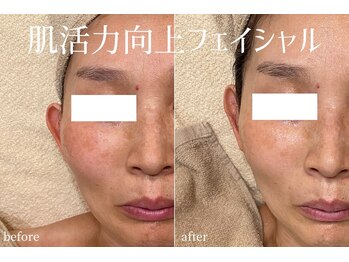 ハティア(hattia)/肌細胞を活性化でエイジングケア