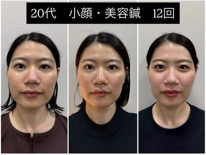 ラムーン(La.Moon)の写真