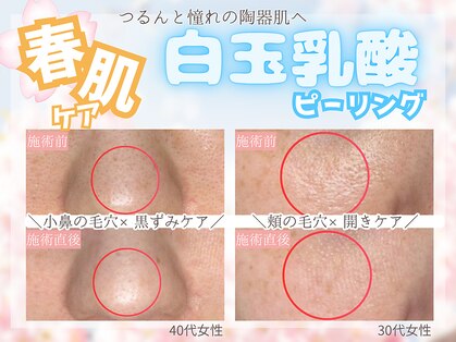 ローマサロンの写真