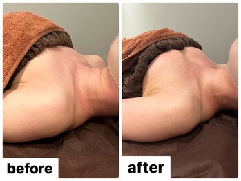 グッドライフエステ/Ｂｅｆｏｒｅ＆Ａｆｔｅｒバスト