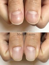 マリーロール 淀屋橋本店(Marie Laure)/自爪育成/深爪矯正/ネイルケア