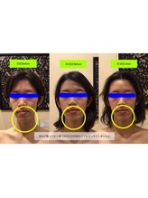 アジール 新潟市(agir)/Before/After画像