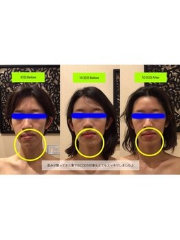 アジール 新潟市(agir)/Before/After画像