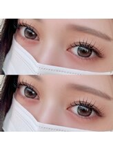 アルビス バイ エニーハウ(Arbis by anyhow)