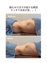 グレースヒーリング(GRACE HEALING)/【腸活】ガスや張りを解消！