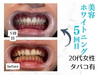 ルカノン(le canon)/結婚式が楽しみです…(*^-^*)